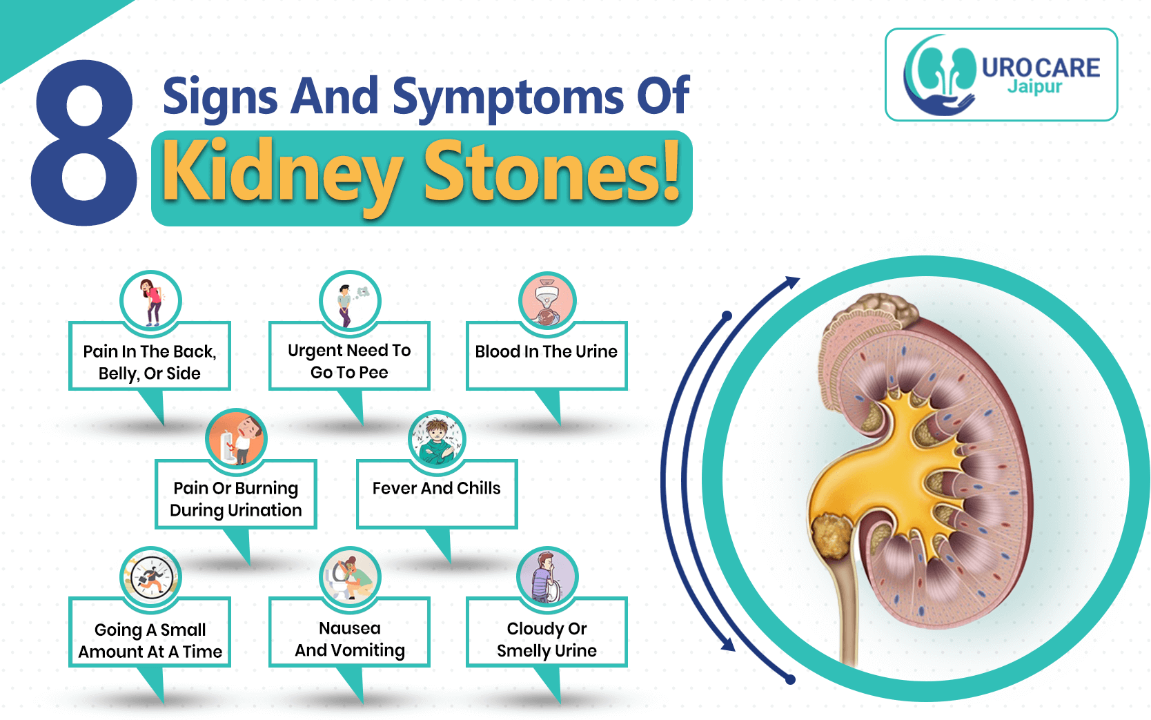 8 Signs And Symptoms Of Kidney Stones